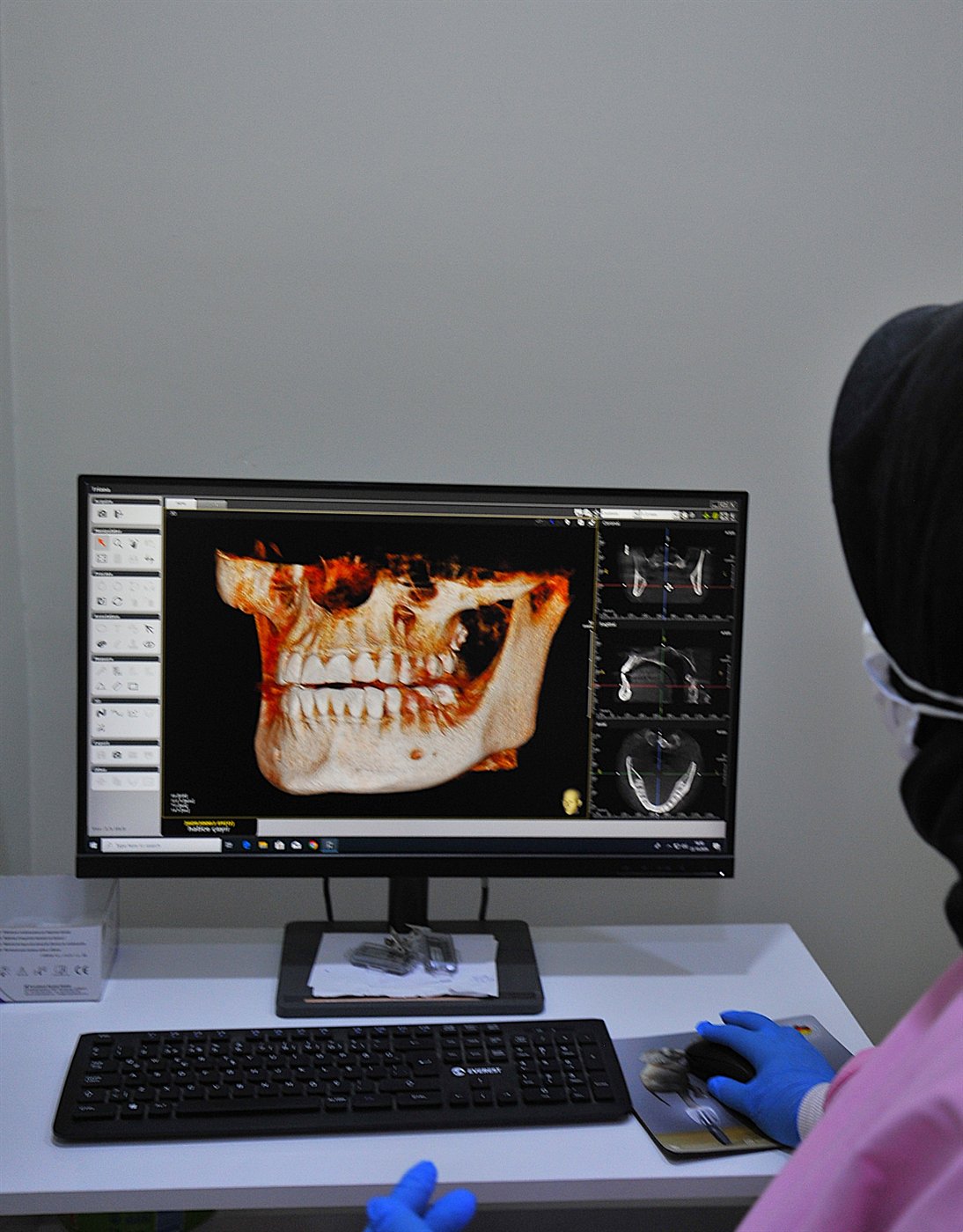 Dental Tomografi (3D)
